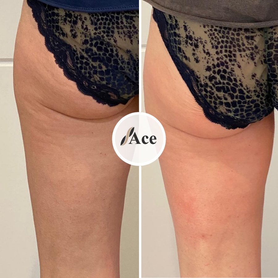 Ace Aesthetics - Ace Aesthetics